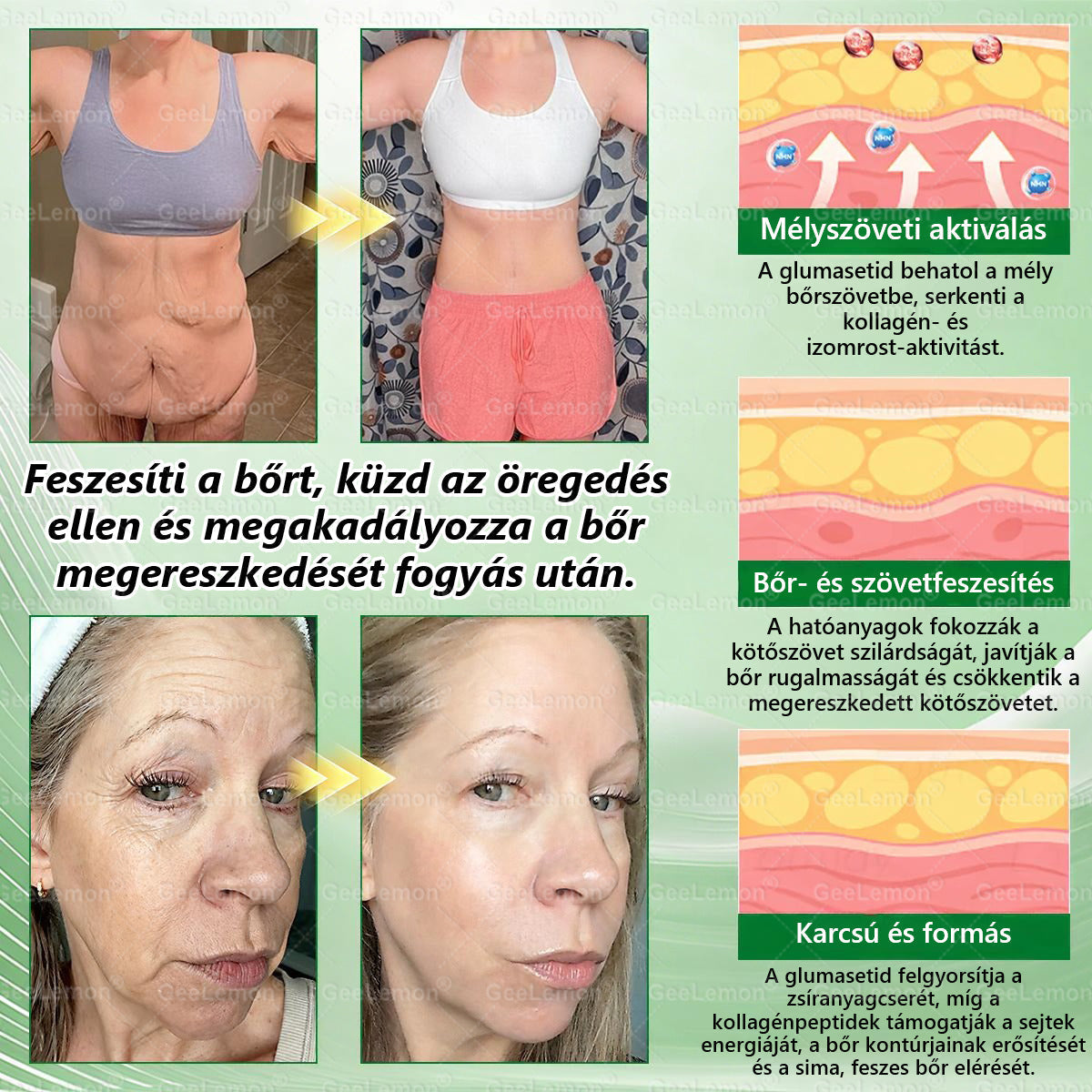 Ajánlott a Semmelweis Kórház által · 👩‍⚕️BENU hivatalos üzlet| 🎄✅ 𝐆𝐞𝑒𝐿𝑒𝐦𝐨𝐧® Glumasetide 8 az 1-ben Karcsú és Egészséges Nano Mikrotűs Tapasz 🇭🇺